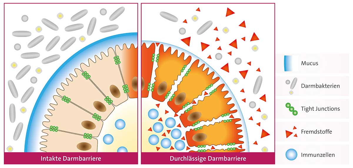 Darmbarriere